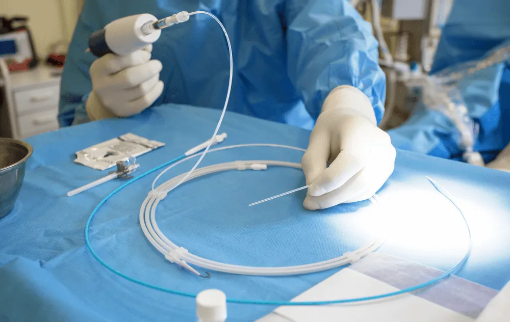 Varicose Vein Treatment