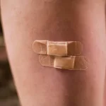 venous vs arterial wounds