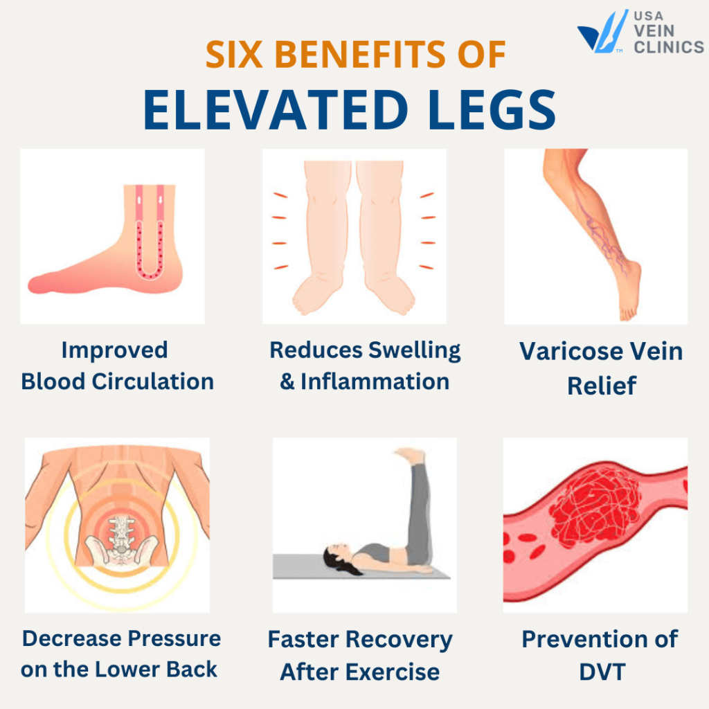 Health Benefits Of Elevating Legs ﻿Improve Circulation & Reduce Swelling
