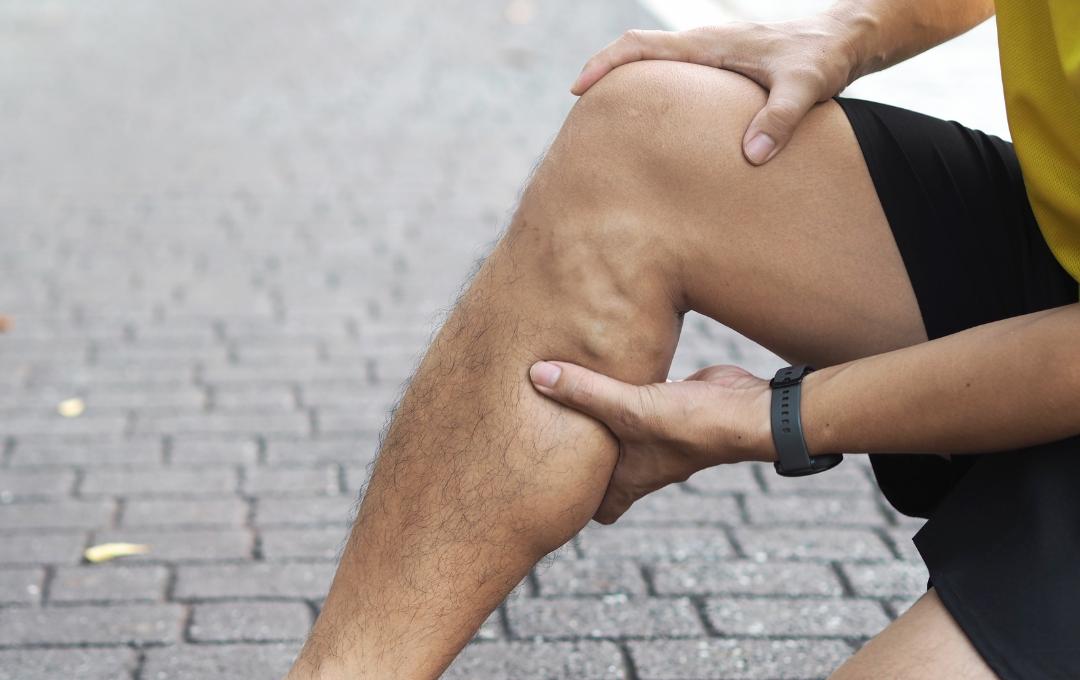 Men and varicose veins