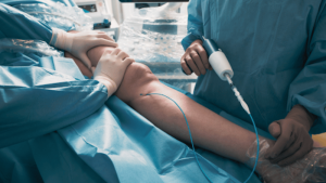 What Is the Best Treatment for Venous Reflux in the Legs