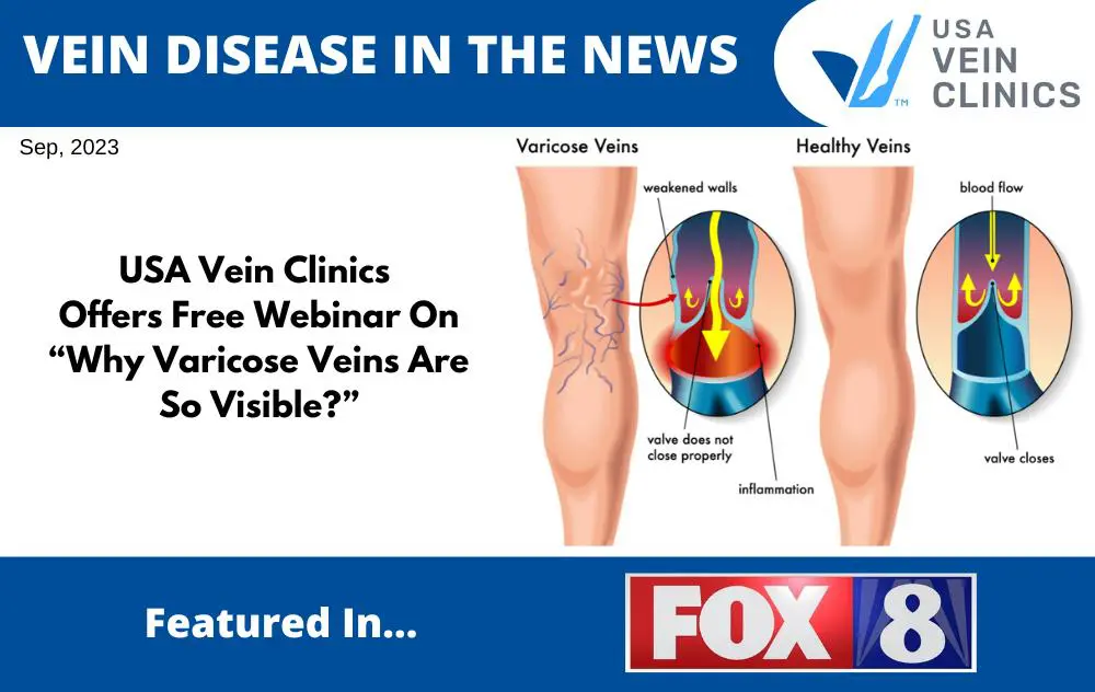 Free veins live event online - ask the expert – The Whiteley Clinic