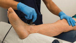 What Does a Venous Ultrasound Show
