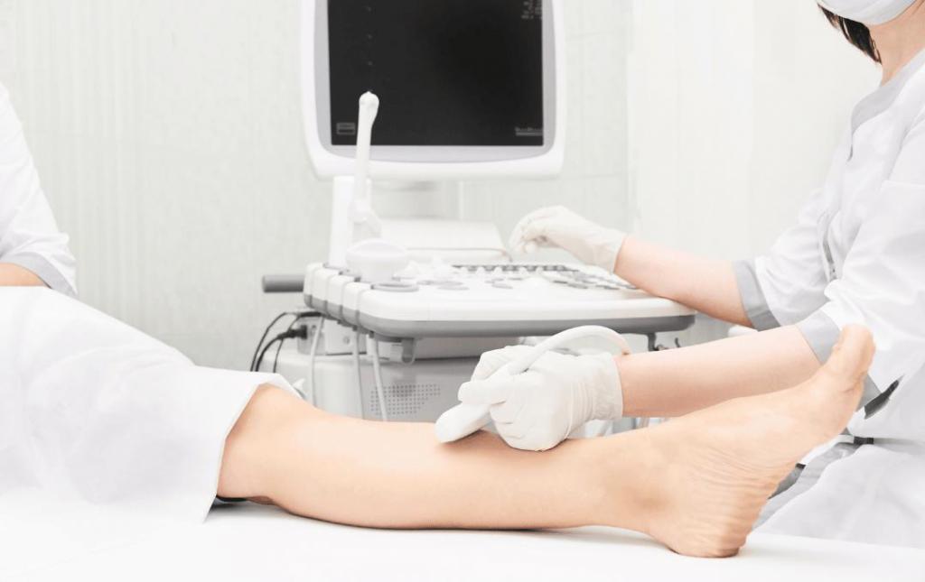 11 Reasons You Need a Vein Screening & Health Check