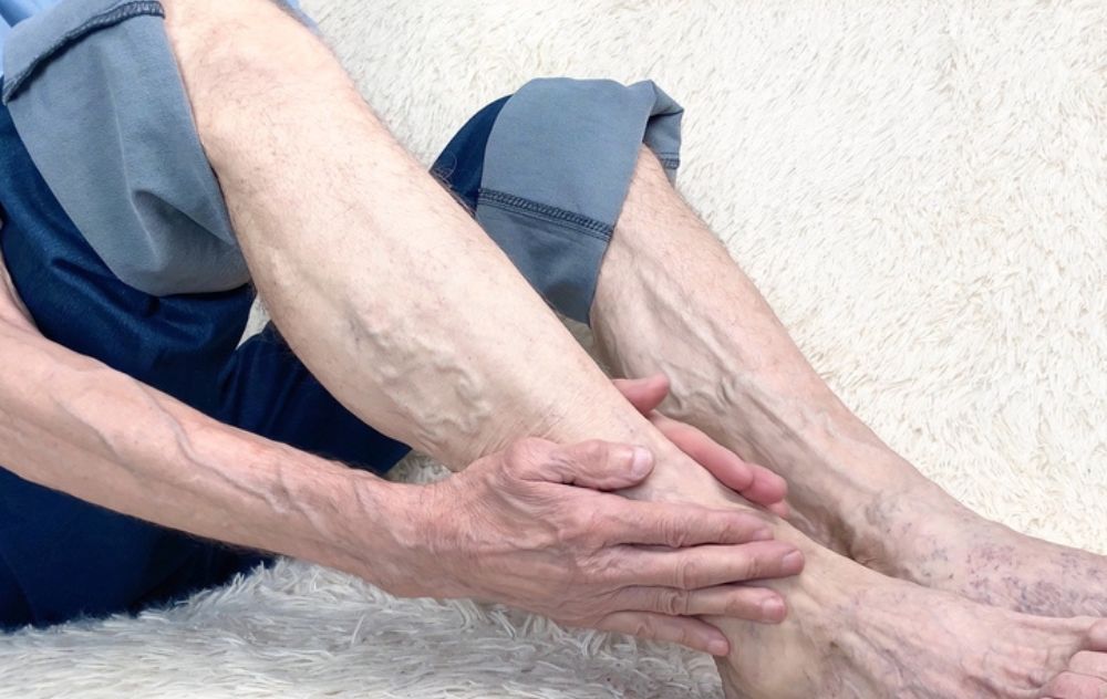 age impacting veins