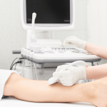 Vein Screening Health Check