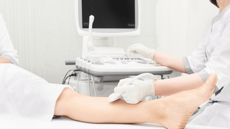 Vein Screening Health Check