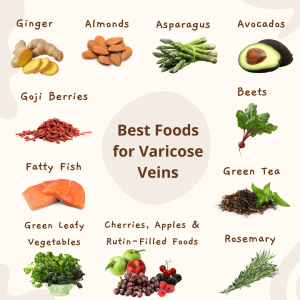 Best Foods for Varicose Veins Graphic