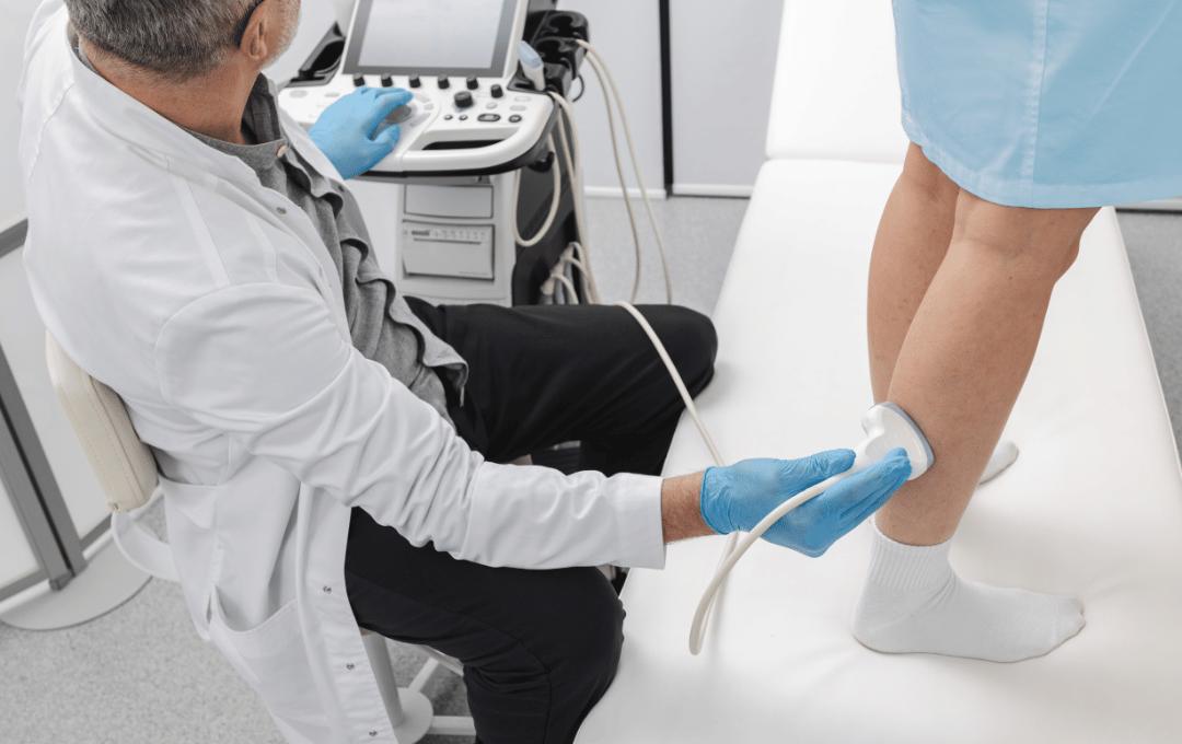 How to Get Rid of Varicose Veins