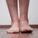 Why Is Only My Left Leg Swelling?