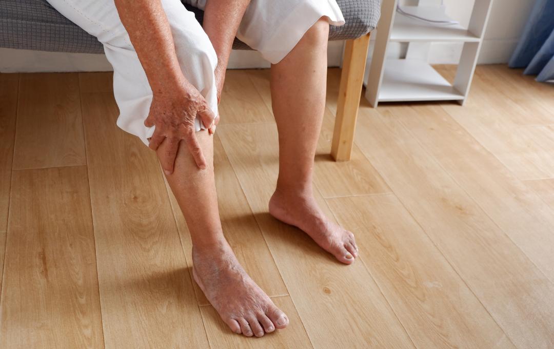 Varicose veins on lower extremities