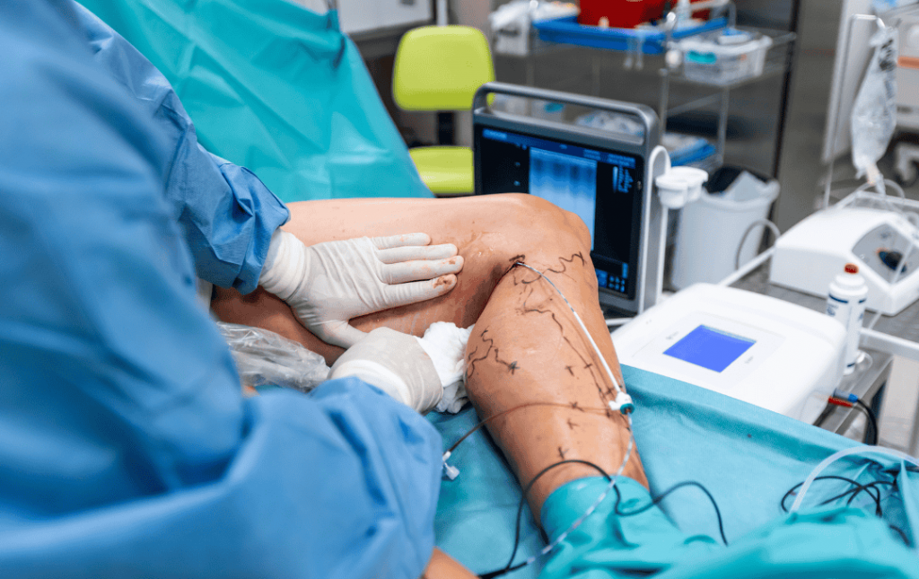Guide to the Vein Ablation Procedure for Varicose Veins