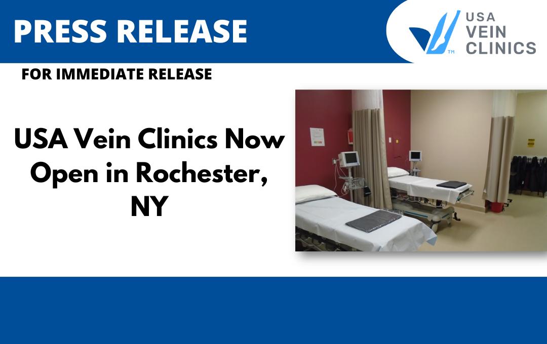 Press Release Rochester NY