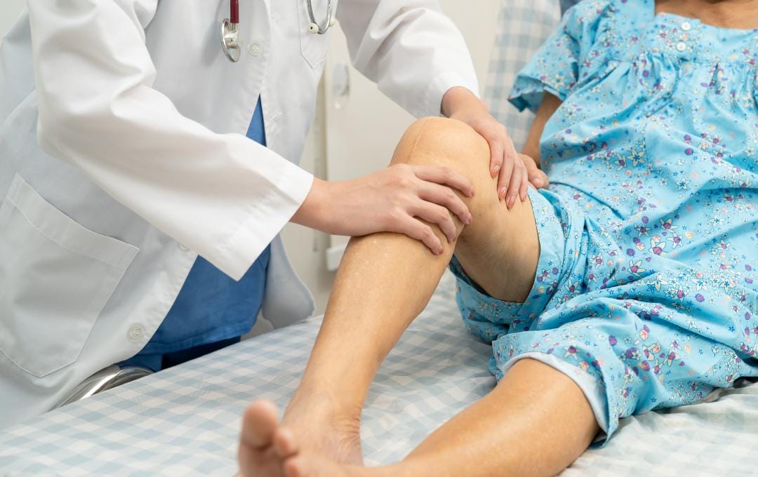 What You Need To Know About Varicose Vein Bruising 6 Vein specialist examines patient's leg