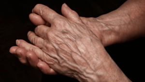Why Are My Hands So Veiny
