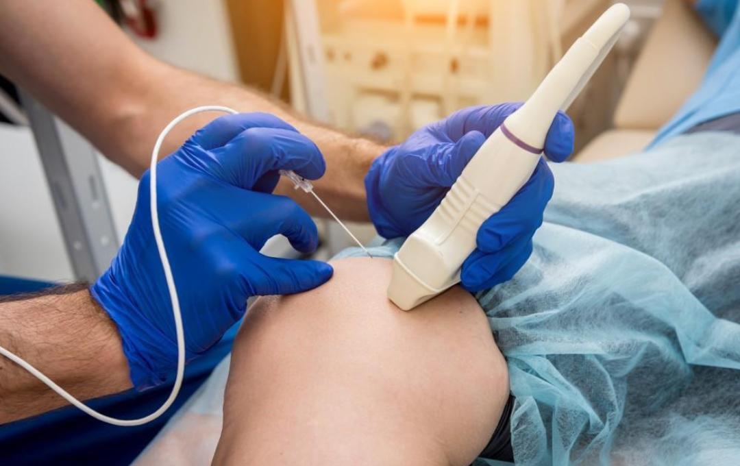 Vein Deductible Procedure