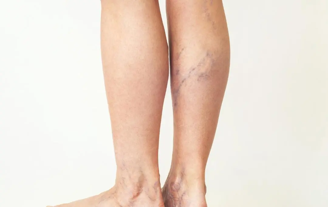 What Blue Vs. Green Veins Mean What Blue Vs. Green Veins Mean