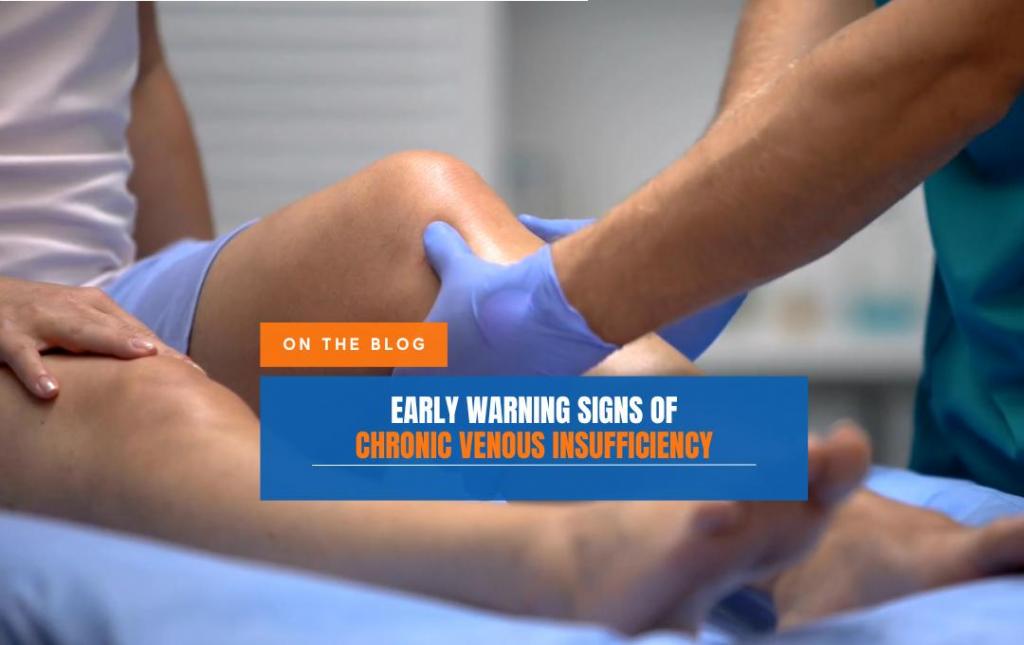 Early Warning signs of Chronic Venous Insufficiency 1