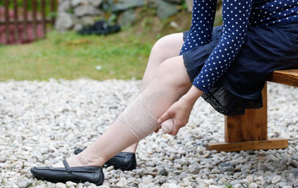 Woman bandages her leg ulcer