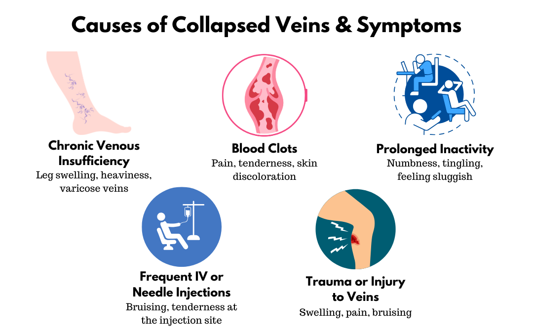 Causes of collapsed veins