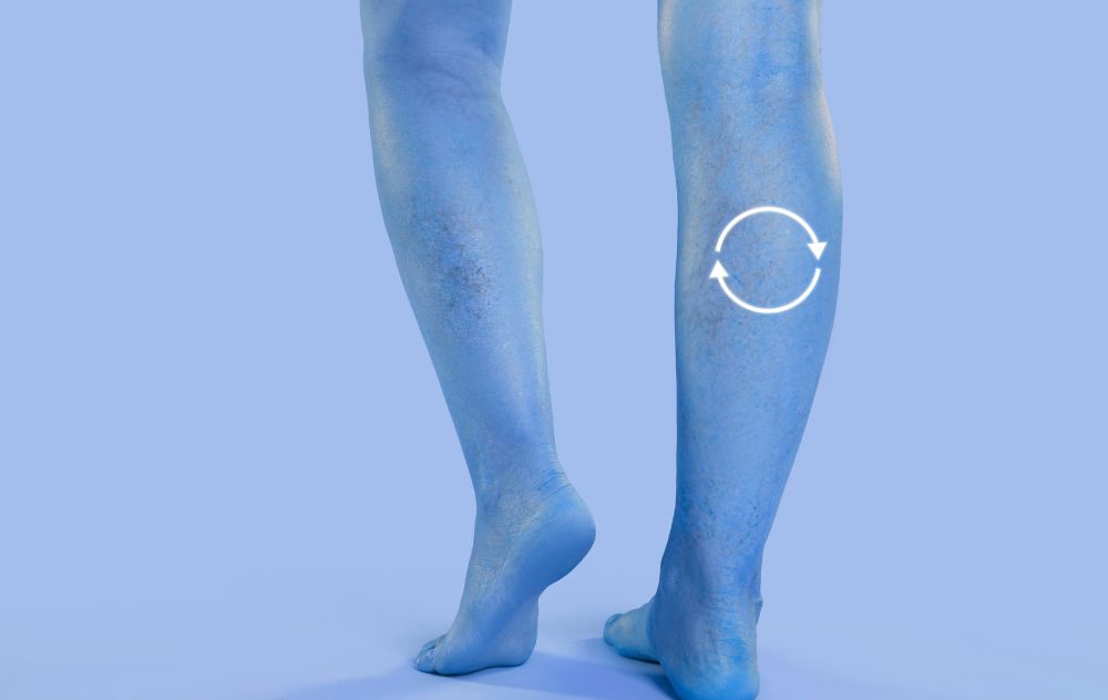 Can You Reverse Chronic Venous Insufficiency