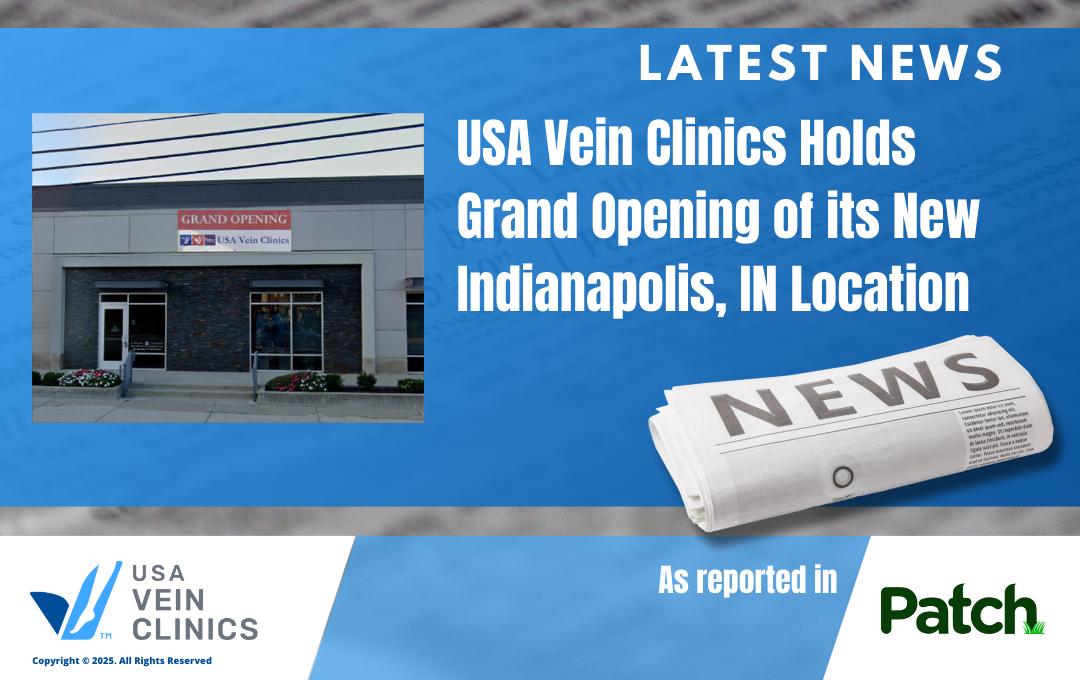 Vein treatment in Indianapolis, IN