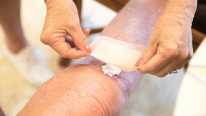 Types of Leg Ulcers and Their Risk of Amputation