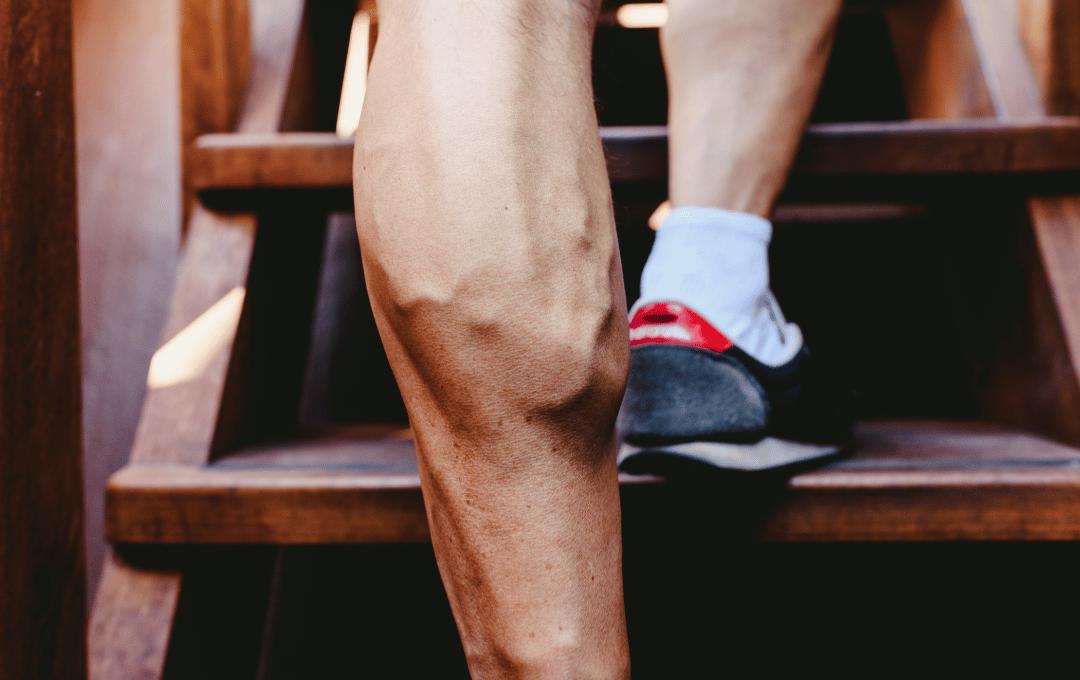 Can Vein Disease Cause Leg Fatigue?