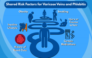 Shared Risk Factors for Phlebitis and Varicose Veins