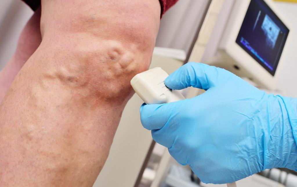 the proper ways to detect CVI