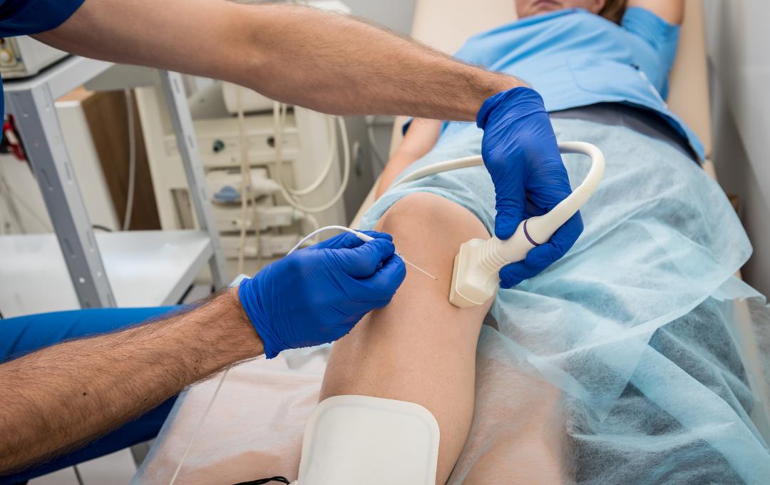 Trump may need a minimally invasive procedure to treat his chronic venous insufficiency
