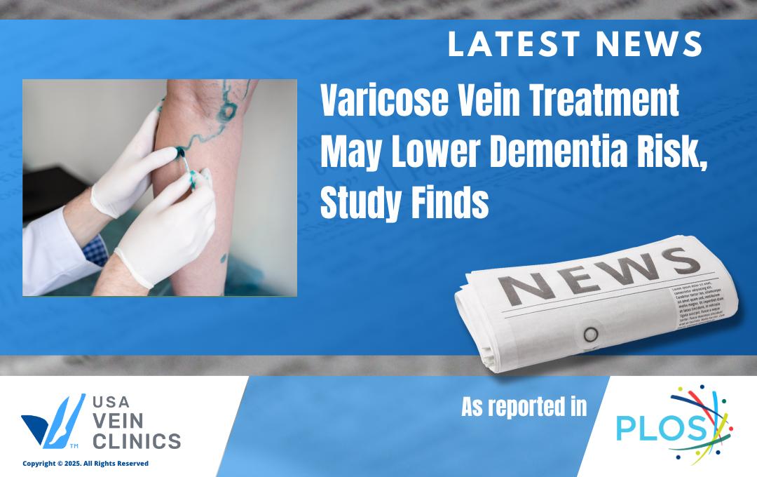 Latest News Vein Treatment May Lower Dementia Risk