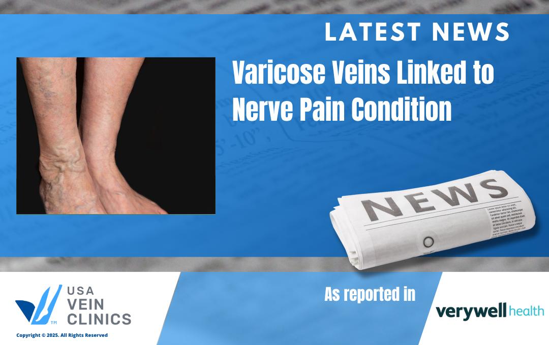 varicose veins and tarsal tunnel syndrome