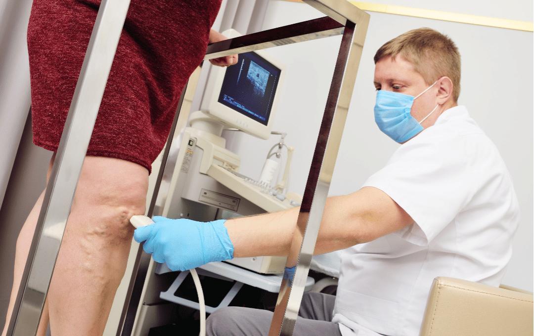 Chronic Venous Insufficiency Test