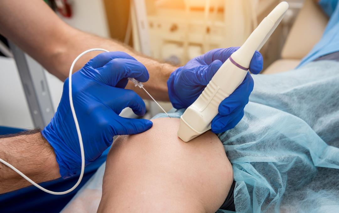 What Years Of Sitting Does To Your Body 7 radiofrequency ablation for varicose veins stemmed from sedentary lifestyle