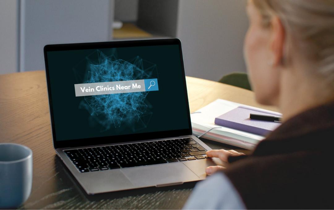 Women with varicose veins searches for vein clinics near her.