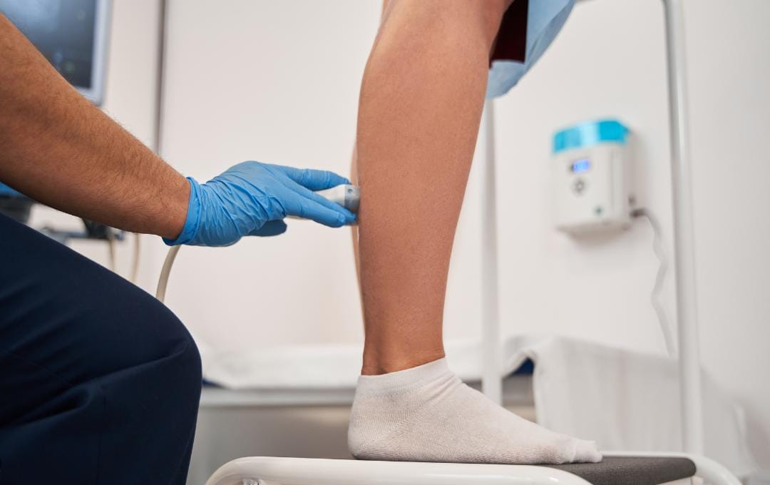 How To Get Rid Of Spider Veins 6 A vein specialist uses a doppler ultrasound to diagnose vein disease.