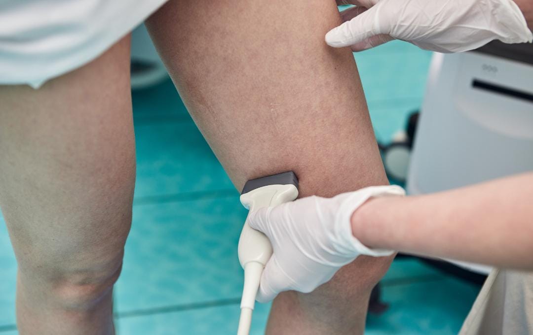How Do I Know My Varicose Veins Need Treatment? 6 Varicose vein consultation with a diagnostic ultrasound.
