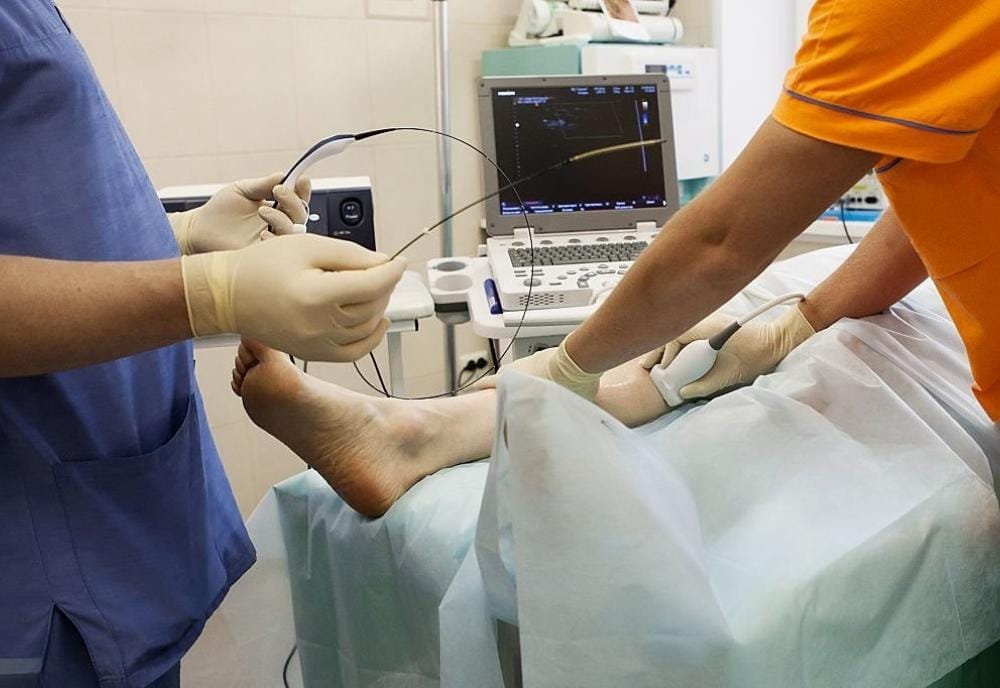 What Is Phlebitis? Causes, Symptoms &Amp; Treatment 6 Patient getting a vein screening done to determine the best treatment for phlebitis.