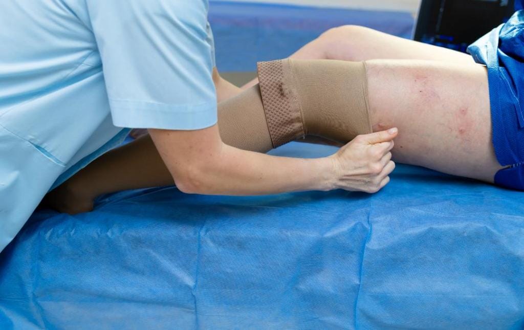 Varicose Vein Treatment Recovery 14 Compression sock fitting to prepare for a varicose vein treatment recovery.