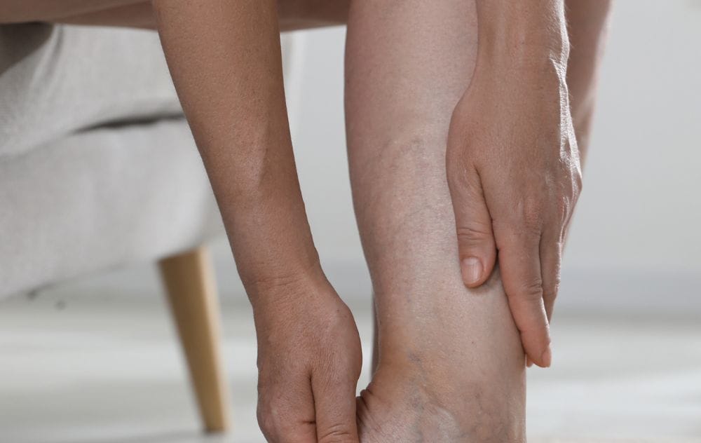 Normal Veins Vs Reticular Veins: Key Differences 5 Normal Veins on Legs