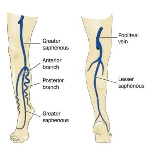 Varicose Veins Behind The Knees 7 Small Saphenous Vein