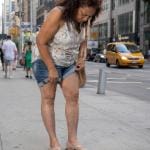 What Does An Unhealthy Vein Look Like? 9 Woman wondering what unhealthy veins looks like