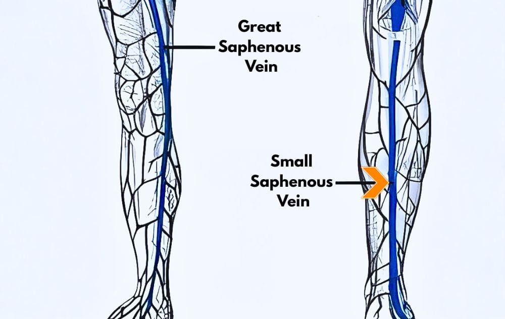 What Is The Small Saphenous Vein? 4 What Is the Small Saphenous Vein?