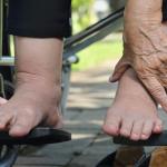Can You Prevent Blood Pooling? 10 Blood Pooling