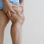 Are Varicose Veins A Warning Sign Of Blood Clots? Signs To Know 14 Patient with varicose veins on legs receiving evaluation for blood clot risk at USA Vein Clinics
