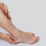 Why Are My Veins Green? Causes, Meaning, And When To See A Specialist 6 Why Are My Veins Green?