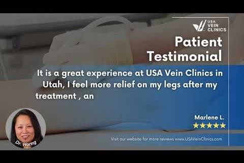 USA Vein Clinics testimonial in Utah