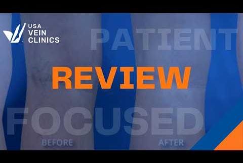 USA Vein Clinics