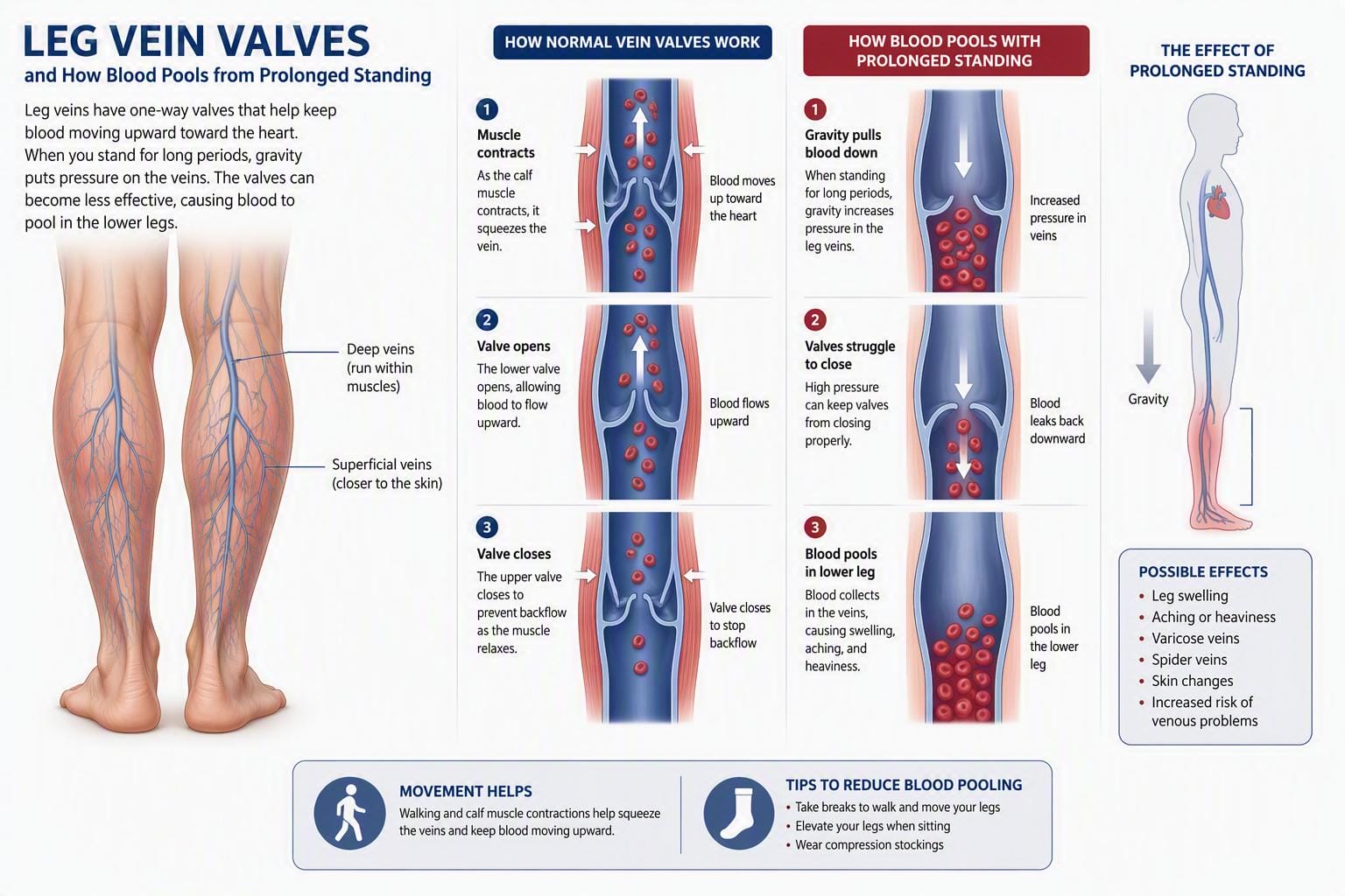 How To Elevate Your Legs Properly For Vein Health 5 Valves standing